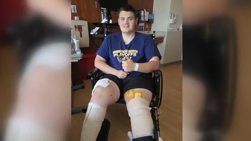 Mason Kramer, 18, fell and got his legs stuck in a silo unloader while working on his farm....
