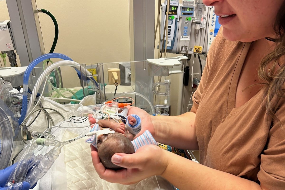 Baby born weighing 1 pound expected to go home after spending over 400 days at hospital